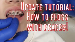 Updated tutorial How to floss with braces🦷 [upl. by Cory]