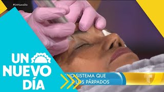 Fibroblast el tratamiento que te rejuvenece sin cirugías  Un Nuevo Día  Telemundo [upl. by Carilyn]