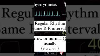 FA flutter TJ TV TDP en moins d’une minute  cardiologie [upl. by Krystalle950]