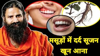 Gums Swelling का घरेलू इलाज। masudon ki sabhi problem Ka Ilaj। मसूड़ों में infection [upl. by Moina]