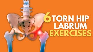 Top 6 Exercises For Naturally Healing A Painful Torn Hip Labrum [upl. by Clarissa896]