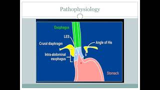 Gastroesophageal Reflux GERGERD [upl. by Salvay568]