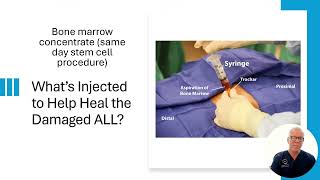 Treatment of DMX Detected Retrolisthesis tALL Procedure [upl. by Anitnelav]