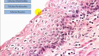Histopatología  Tejido Epitelial II [upl. by Hnamik670]