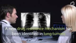 NEW DRUG RESISTANCE MECHANISM IN LUNG CANCER  Fernando J de MIGUEL  EVisibility Infographics 03 [upl. by Seditsira]