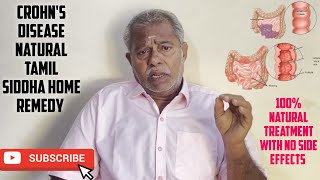 Crohns disease treatment in tamil  Best natural home remedy for crohns disease  Marunthu Venduma [upl. by Harac]