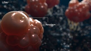 Neoplasm  3D Animation [upl. by Hbaruas]