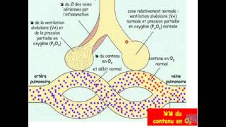 Semiologie de linsuffisance respiratoire Partie 1 [upl. by Eyak]