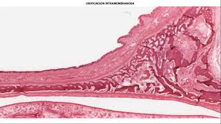 Histología Osificación [upl. by Ahsema]