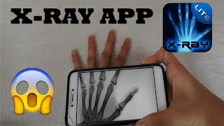 XRay App [upl. by Leuqer722]