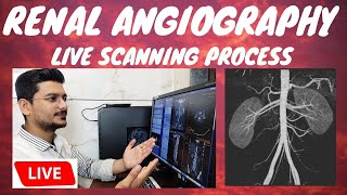 CT RENAL ANGIOGRAPHY LIVE SCAN  Live ct scan of renalabdominal Angiography radiologytechnologist [upl. by Senior]