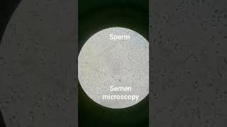 sperm under microscope [upl. by Htezzil709]