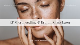 RF Microneedling amp Erbium Glass Laser  Benefits How it works [upl. by Ojoj222]