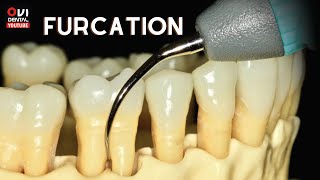 FURCATION The anatomic area of a multirooted tooth where the roots diverge [upl. by Leith396]