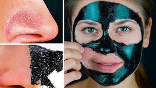 11 Masques Pour le Visage Faciles Avec 2 Ingrédients à Préparer en Une Minute [upl. by Harpp]