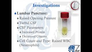 CNS Infection 5 Meningitis الالتهاب السحائي [upl. by Kcirrem]