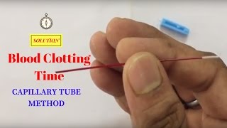 Blood Clotting Time Determination by Capillary Method  आपका खून कितने समय में जमता है कैसे पता करें [upl. by Zubkoff784]