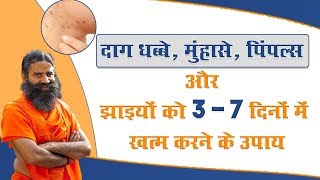 दाग धब्बे मुंहासे पिंपल्स और झाइयों को 3  7 दिनों में खत्म करने के उपाय  Swami Ramdev [upl. by Nimajnab19]