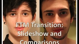 FTM transgender transition timeline slideshow and comparisons nearly 3 years on T [upl. by Andi898]