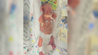 Baby born at 23 weeks old [upl. by Veda]