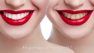 Dentist Calgary Canada Dentist Calgary  Beddington Dental Veneer [upl. by Viole]