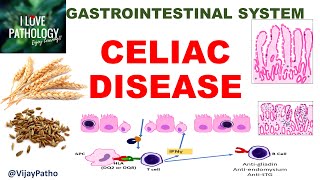 Celiac disease Etiopathogenesis Morphology amp Clinical features GIPath ilovepathology [upl. by Ingalls633]