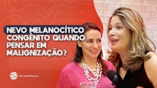 Nevo melanocítico congênito quando pensar em malignização [upl. by Ebag]