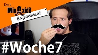 Um ein Haar zuviel Nebenwirkung  Das Minoxidil Experiment Woche7 [upl. by Kauffmann]