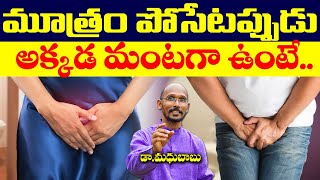 మూత్రం పోసేటప్పుడు అక్కడ మంటగా ఉంటే  Burning Urination  Dr Madhu Babu  Health Trends [upl. by Kiersten]