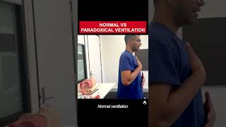 Normal vs Paradoxical Ventilation  anesthesia bagmaskventilation airway [upl. by Eralcyram]