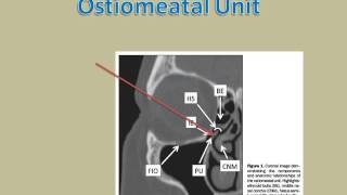 ostiomeatal unit [upl. by Hartnett260]