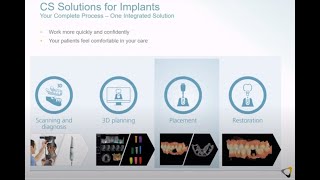 Carestream Dental SMOP Digital Dental Implant Guided Surgery [upl. by Yntrok]