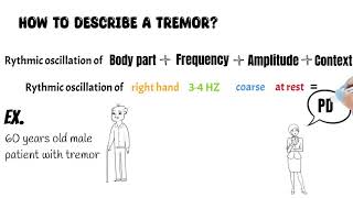 Tremor syndromes All you need to know about tremor types examination and treatment [upl. by Eesyak]