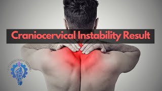 Craniocervical instability CCI Rehab Journey with Coach Chong  Hyperarch Fascia Training [upl. by Oiciruam190]