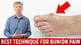 Bunion Pain Relief – The Simple amp Best Technique by DrBerg [upl. by Hanan524]