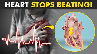 What Happens During Cardiac Arrest [upl. by Aleedis]