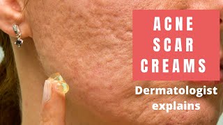 Acne Scar Creams  Dermatologist Reviews [upl. by Aicrop878]