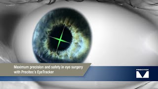 Precitec 6D EyeTracker maximum precision and safety for refractive laserassisted eye surgery [upl. by Ahsirtak]