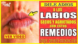 Como Quitar Los Labios Secos Y Agrietados Con Estos Remedios Caseros [upl. by Windham]