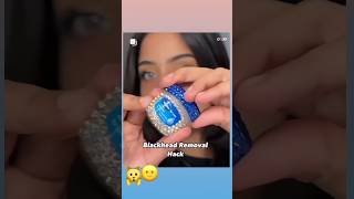 blackhead Hack With Vaseline 😱😱unbelieve this 😲😲blackheads blackheadremovalamazinghackshack [upl. by Xet430]