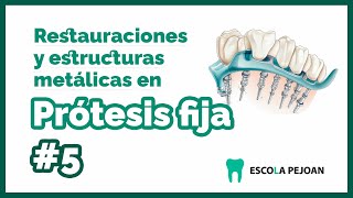 Módulo 5 Restauraciones y Estructuras Metálicas en Prótesis Fija  Grado Superior Prótesis Dentales [upl. by Araem]