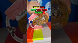 DEFINITELY AVOID this CANDY with BRACES ORTHODONIST REACTS 👀 braces candy crunchy [upl. by Nol71]