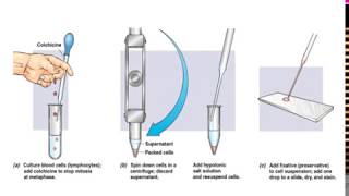 What is Karyotyping [upl. by Atneuqal]