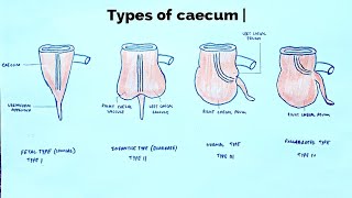 Types of caecum  med tutorials [upl. by Annayram]