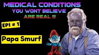 REAL LIFE Papa Smurf   Learning Medicine Can Be FUN [upl. by Odla]