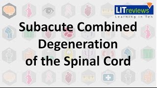 Subacute Combined Degeneration of the Spinal Cord [upl. by Ainadi]