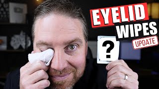 I Found the BEST Eyelid Wipes for Blepharitis and Dry Eyes 2024 [upl. by Donnie130]