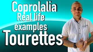 Coprolalia Part 2 Tourette’s real examples from my experience tics tourettes tourettesyndrome [upl. by Yadrahs497]