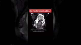 36 weeks baby in uterus pregnancy ultrasound🥰🥰🥰viralvideo trending baby [upl. by Maje]