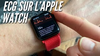 Astuce 14 ECG de lApple Watch [upl. by Holt]